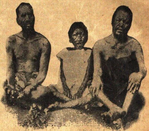 Island Lepers.